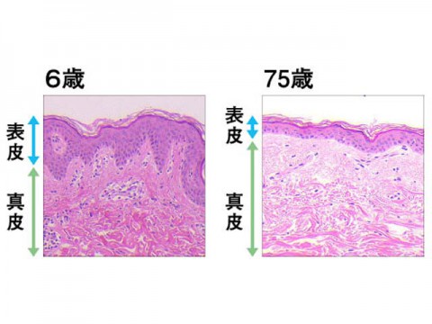 誰にでも起こりうる「肌粗しょう現象」とは！？