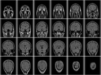 画・ラジオを聞くと頭が良くなる。脳科学者がMRI解析から証明。右脳の成長も。