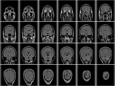 ラジオを聞くと頭が良くなる。脳科学者がMRI解析から証明。右脳の成長も